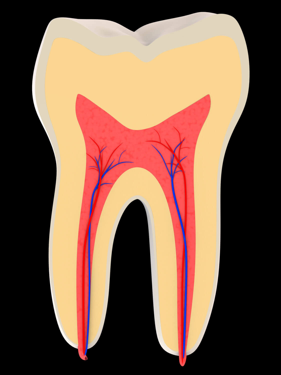 Root Canals